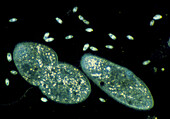 LM of freshwater ciliate Paramecium