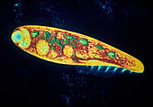 LM of Blepharisma americanum,a ciliate protozoa