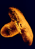 SEMs of ciliate protozoan consume fellow ciliate