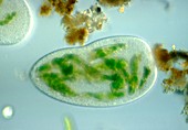 LM of a Paramecium,showing food vacuoles