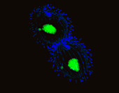 Tetrahymena protozoa