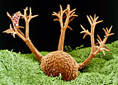 Dendrocometes protozoan