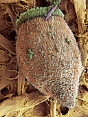 Ciliate protozoan,SEM