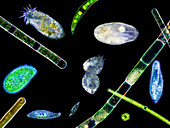 Ciliate protozoa,light micrograph