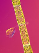 Vorticella on a plant,light micrograph