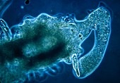 LM of an amoeba engulfing a paramecium