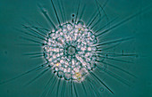 Heliozoan amoeba