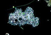 LM of Amoeba proteus