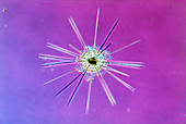 LM of an Acantharian,Acanthoplegma sp