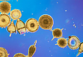 LM of different species of Radiolaria