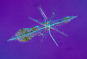 LM of a marine radiolarian,Amphiloche elongata