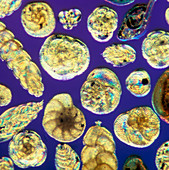 LM of assorted Foraminifera shells