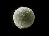 SEM of toxoplasma cyst