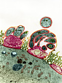 Intestinal protozoan parasites,TEM