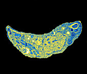 Toxoplasma parasite,TEM