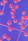 Light micrograph of sponge spicules