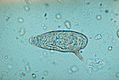 Lm of blood fluke Schistosoma mansoni