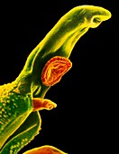Coloured SEM of Schistosoma (bilharzia) fluke