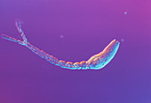 Schistosome parasite