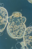 Larva of dog tapeworm Echinococcus granulosus