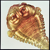 Scolex (head) of a beef tapeworm,Taenia saginata