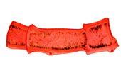 Pork tapeworm,light micrograph