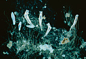 Light micrograph of bdelloid rotifers