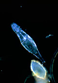 Hatching egg of rotifer