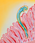 Artwork of hookworm clinging to intestinal lining