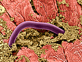 Threadworm in intestine,SEM