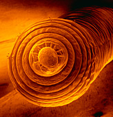SEM of head of the earthworm