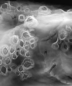 Rock oyster barnacles,X-ray