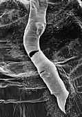 Breathing tube in fruit fly puparium