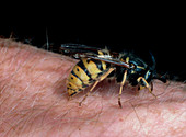 Common wasp stinging human