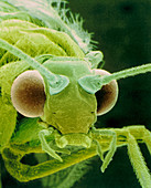SEM of a common lacewing,Chrysopa septempunctata
