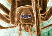 Spider's head,ESEM