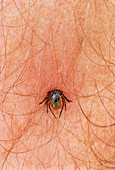 Unidentified tick feeding on human blood