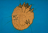 Illustration of the itch mite,Sarcoptes scabei