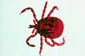 Light micrograph of the tick Ixodes amblyomma