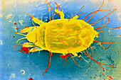 False-colour SEM of dust mite