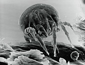 SEM of a dust mite