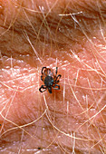 Macrophoto of Lyme disease tick nymph,Ixodes sp