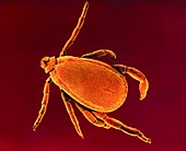 Colour scanning electron micrograph of a dog tick