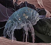 Dust mite,SEM