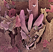 Eyelash mite tails,SEM