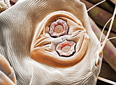 Dust mite suckers,coloured SEM