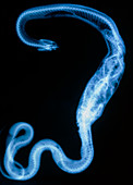 X-ray showing a snake which has swallowed a frog