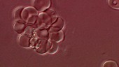 Blood cells in malaria, microscopy