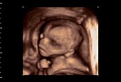 27 week old foetus, 4D ultrasound scan