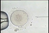 IVF sperm injection procedure